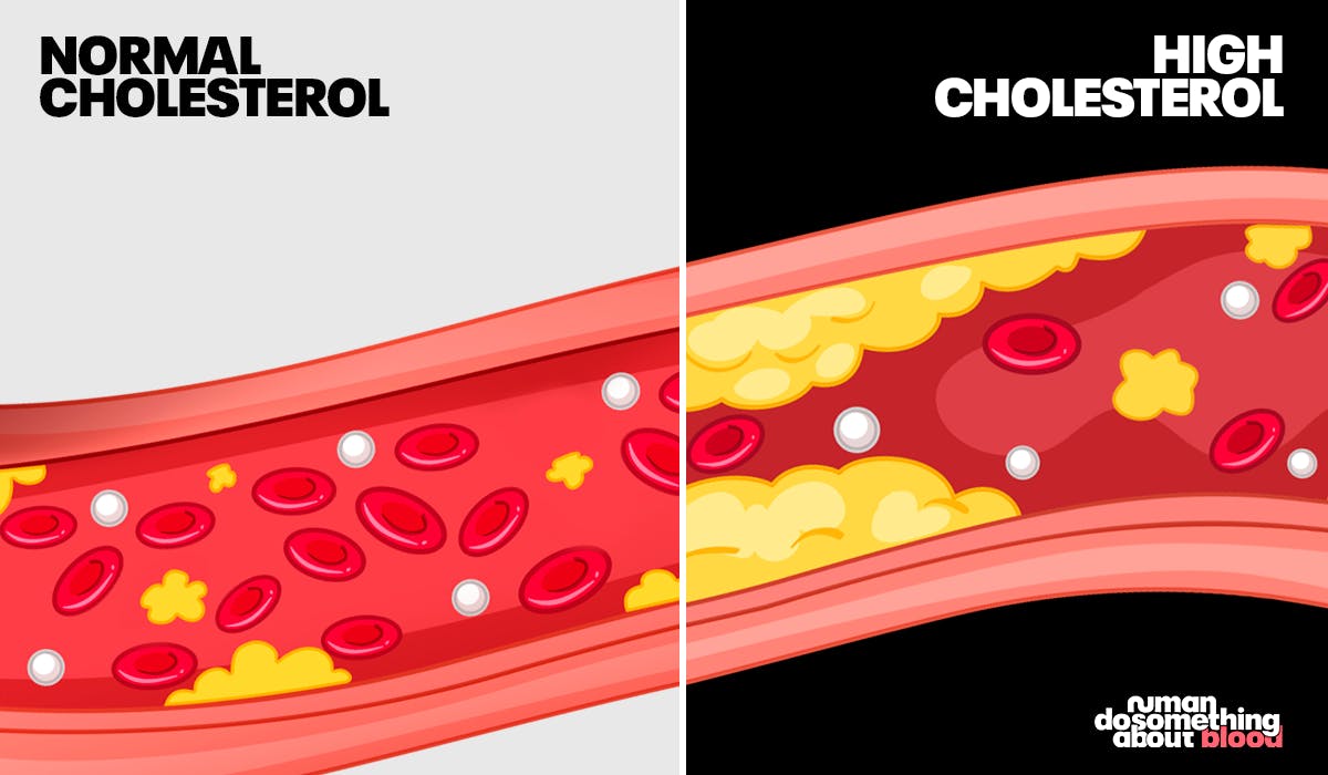 Numankind The ultimate 7 day high cholesterol diet plan